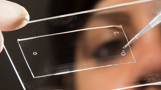 Scientists Can Detect Disease By Dripping Urine Down This Tiny Tube